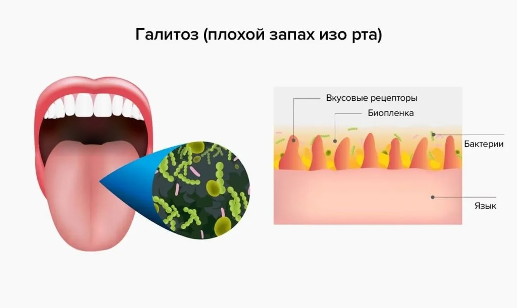 Toxofil : πού να αγοράσετε σε φαρμακείο στην Ελλάδα;